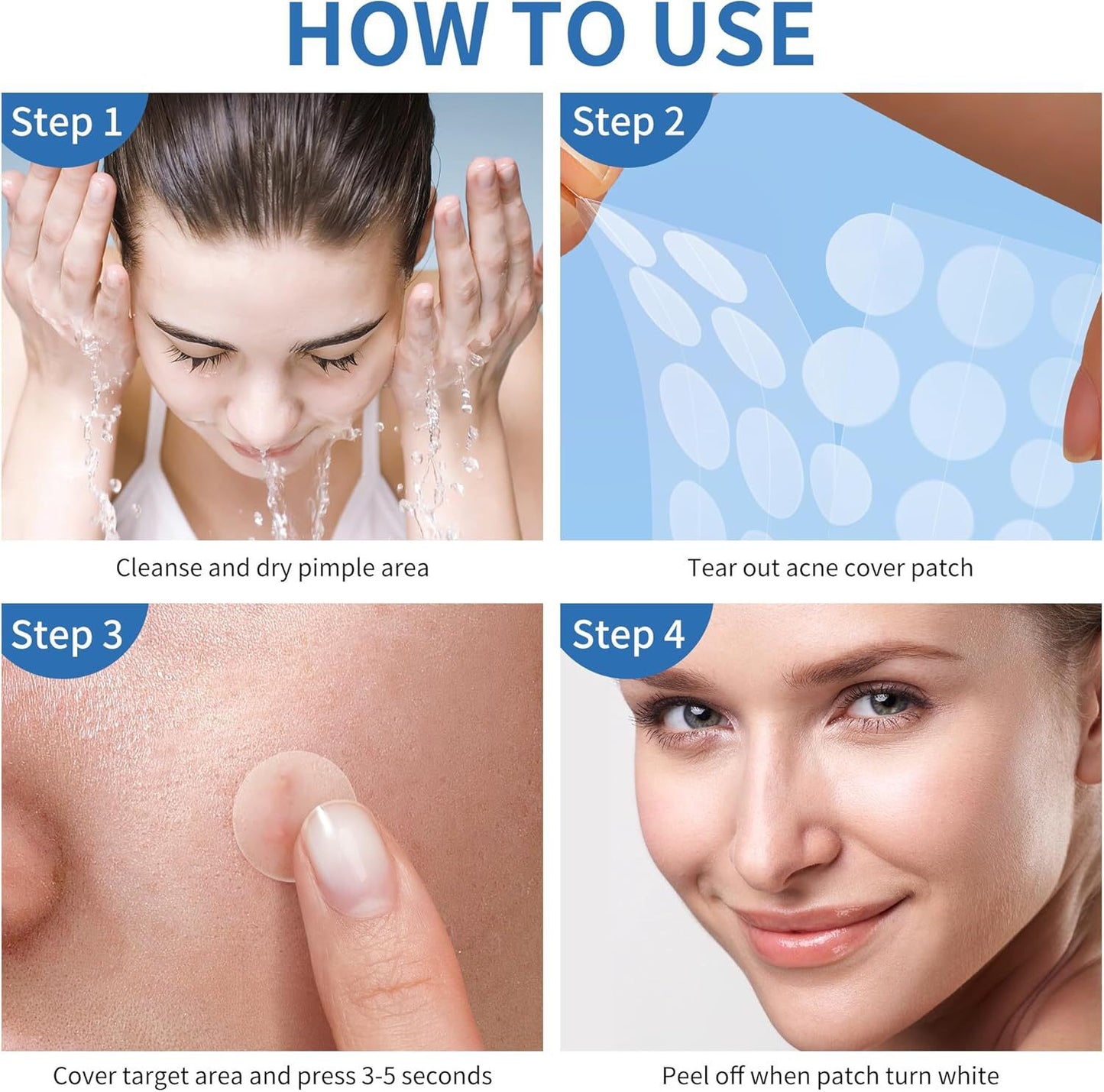 Hydrocolloid Blemish Patches – Gentle Daily Care
