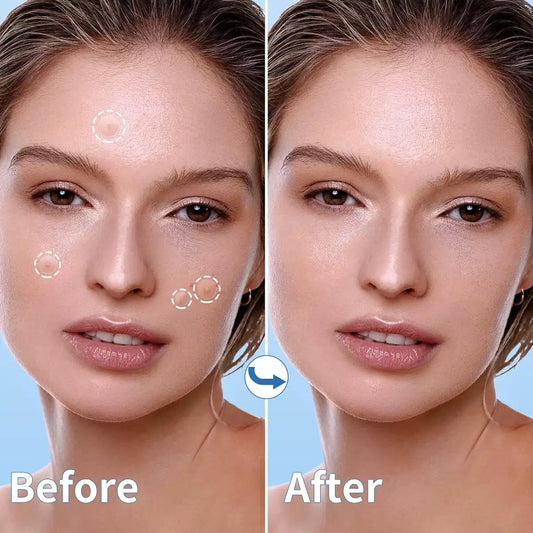 Invisible Ultra-Thin Acne Patches – Covers Pimples & Whiteheads | Day & Night Protection