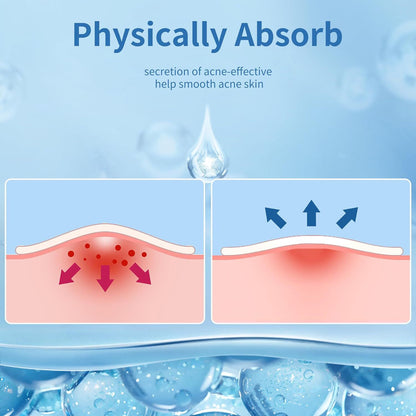 Invisible Ultra-Thin Acne Patches – Covers Pimples & Whiteheads | Day & Night Protection